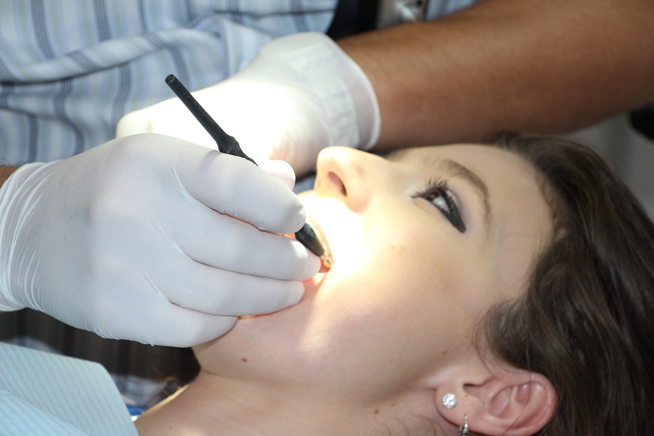 teeth-cleaning-1514692_1280